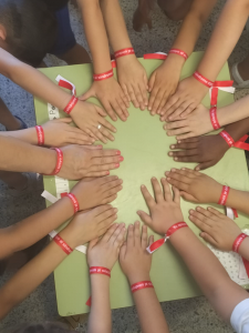 Síndrome KBG pulseras